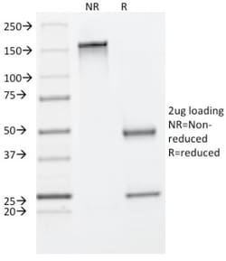Cytokeratin 8 Antibody (C-43), Novus Biologicals 0.2mg; Unlabeled:Antibodies,